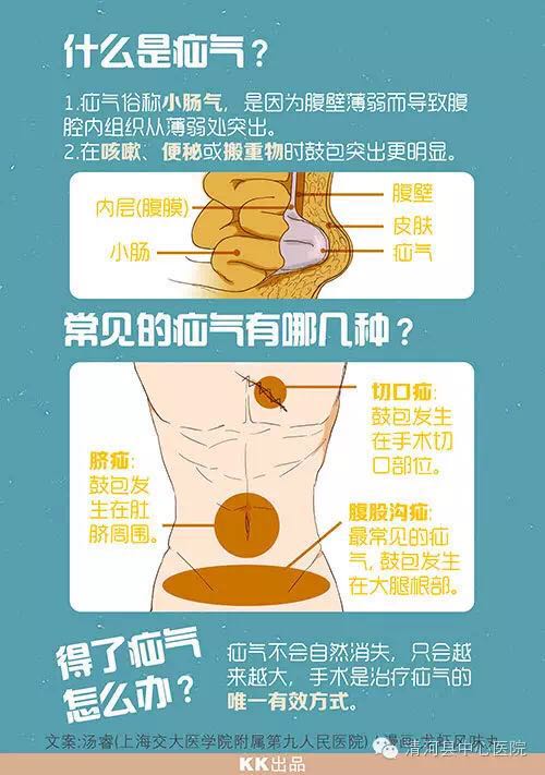 一个巨响的喷嚏过后，他被切下了小肠