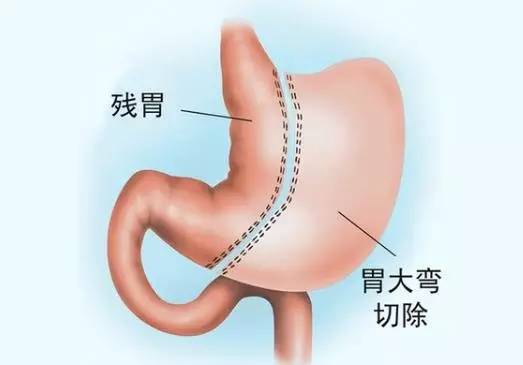 鍜岄檲鍏夋爣杩為害,鍜岄檲鍏夋爣璁ㄨ鍟嗕笟