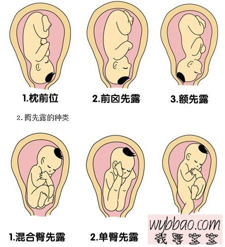 糊涂妈妈的视频,顺产过来人的忠告