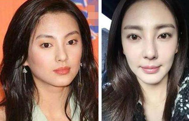 为啥三甲医院做的双眼皮更美,南华博士含金量