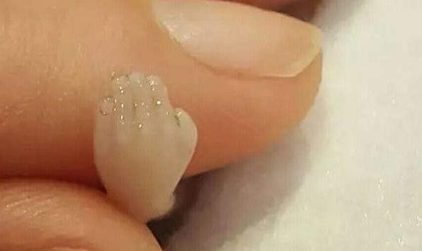 人工流产的胎儿怎么处置,人工流产的胎儿去哪了