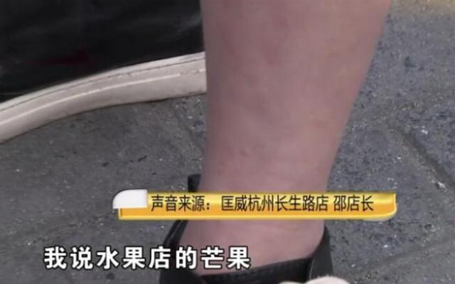 花了569买的匡威鞋，尽然含有致敏成分？脚已经肿到关节了