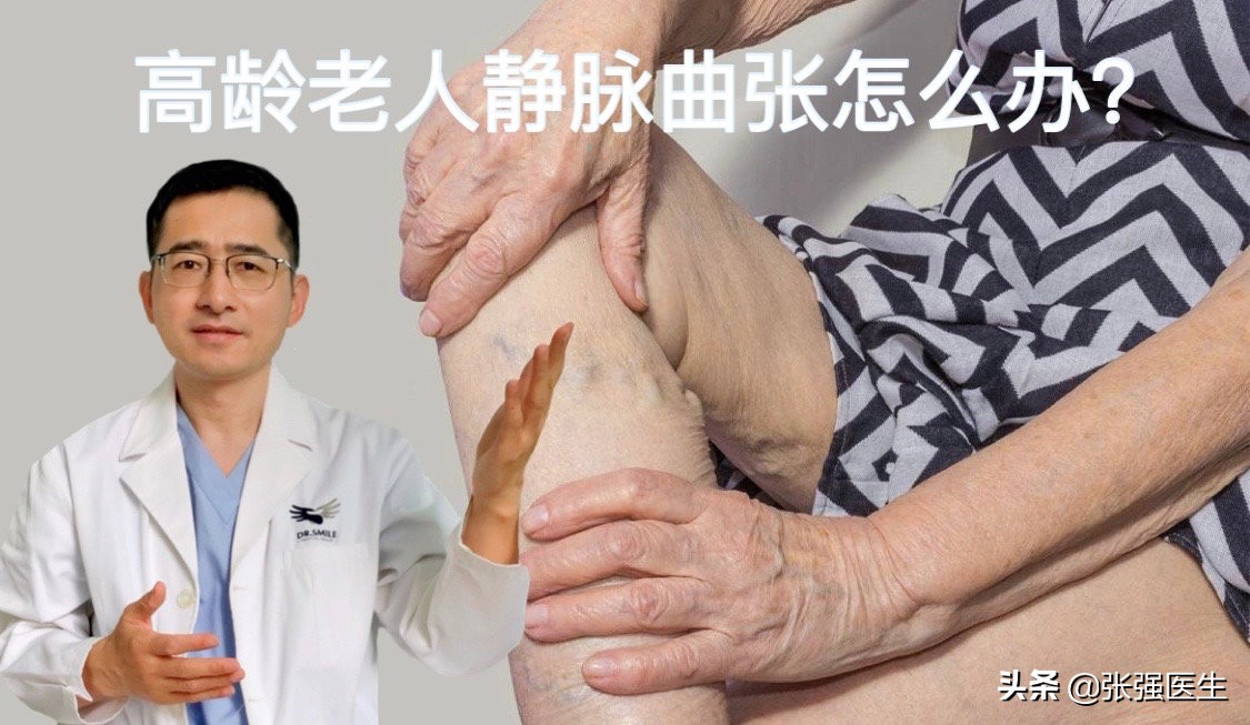 高龄老人静脉曲张破裂怎么办？