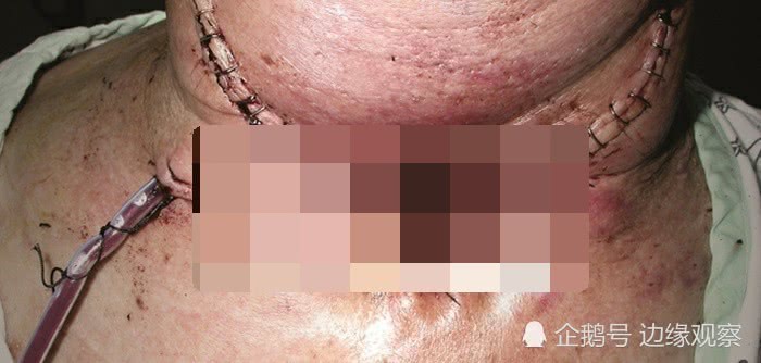 韩国香烟铁盒装,韩国香烟脸谱