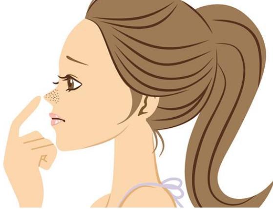 鼻子长黑头如何去除不花钱,鼻子老长黑头怎么办