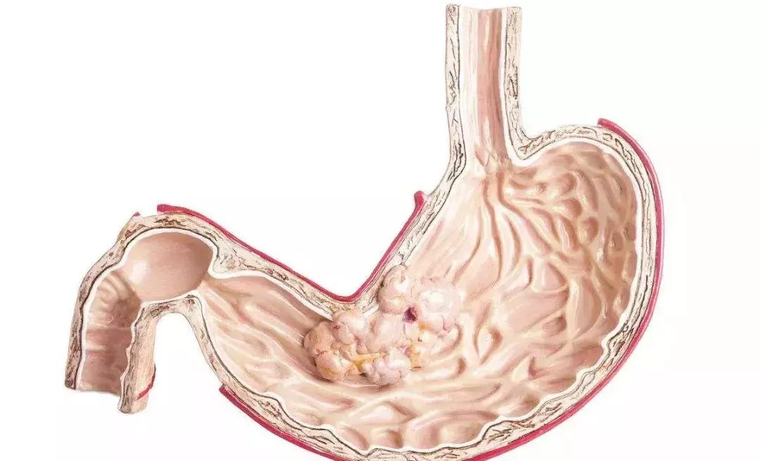 脸颊反反复复长痘就是有炎症,脸上像打了腮红一样是什么原因