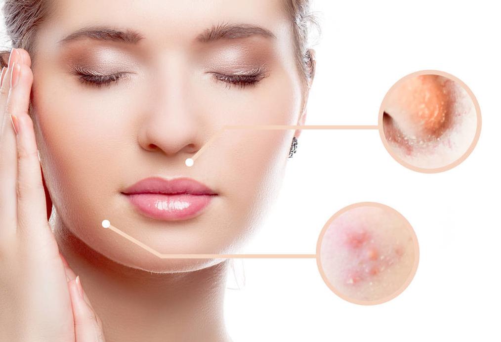 油皮适合黛珂哪一款洗面奶,黛珂洗面奶痘痘肌用什么系列好