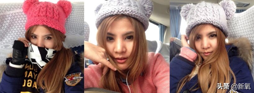 18岁土肥圆豪掷800万全身整形，鼻子6次大整假体穿出，效果却超美