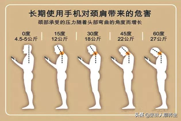 颈椎低头疼痛,低头玩手机如何缓解颈椎疼痛