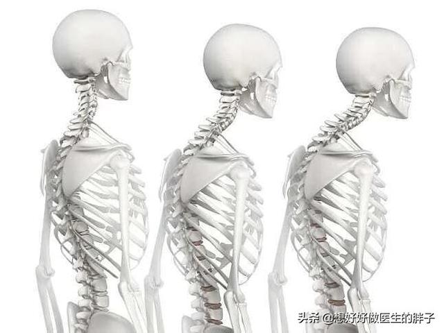 真相脖子后面的富贵包到底是什么,脖子上面的包是富贵包吗