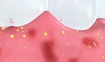 儿童敏感牙齿专用牙膏,敏感牙齿用什么牙膏儿童