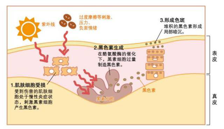 修复淡化黑色素冻干粉提亮美白,祛印美白淡化黑色素推荐