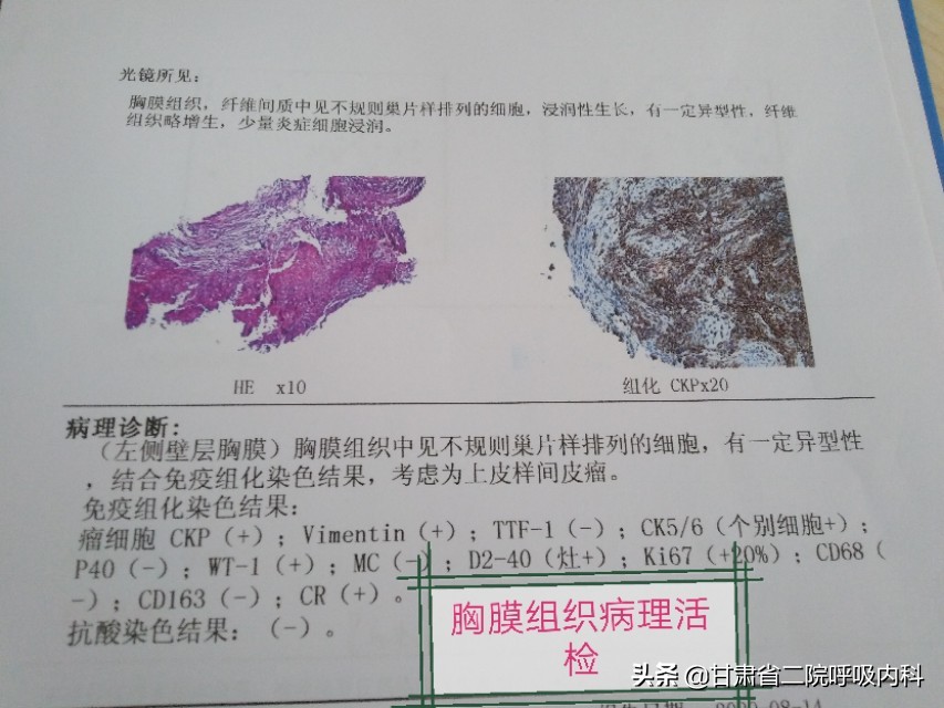 老人咳嗽胸腔积液怎么消除和恢复,老年人反复胸腔积液怎么回事