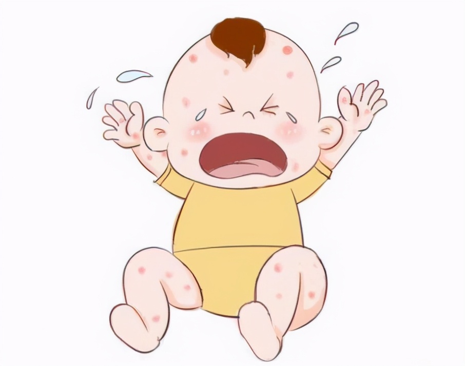 婴儿抗过敏羊奶粉哪个牌子好,抗过敏奶粉什么牌子好