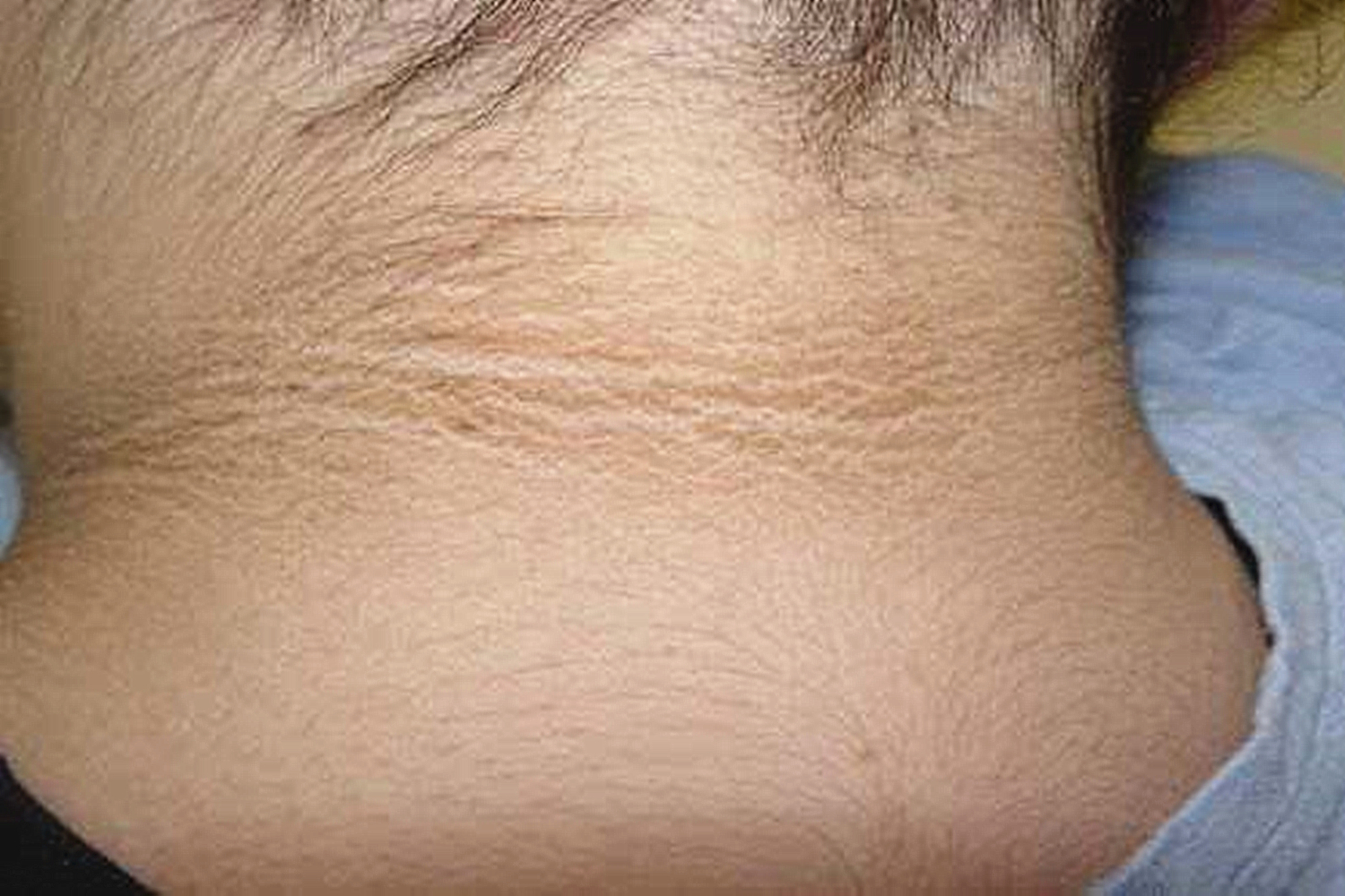 小孩脖子黑拿什么洗好,儿童脖子发黑洗不掉视频