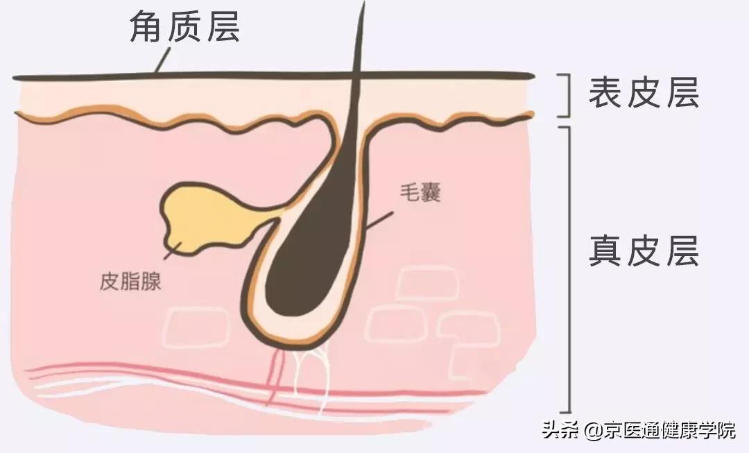 “毛孔粗大”粗的并不是“毛孔”,它是瘢痕呀！三种方法有效解决