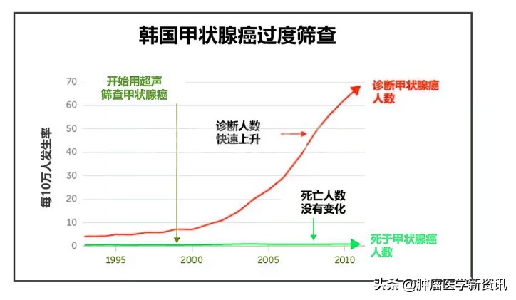 癌症早期早发现早治疗,癌症早发现早诊断早治疗
