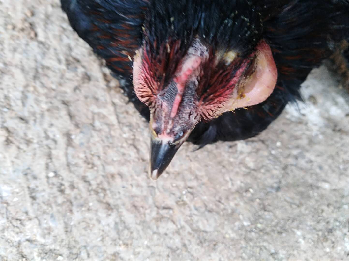 鸡眼是什么原因造成的怎么治,鸡眼详细原因