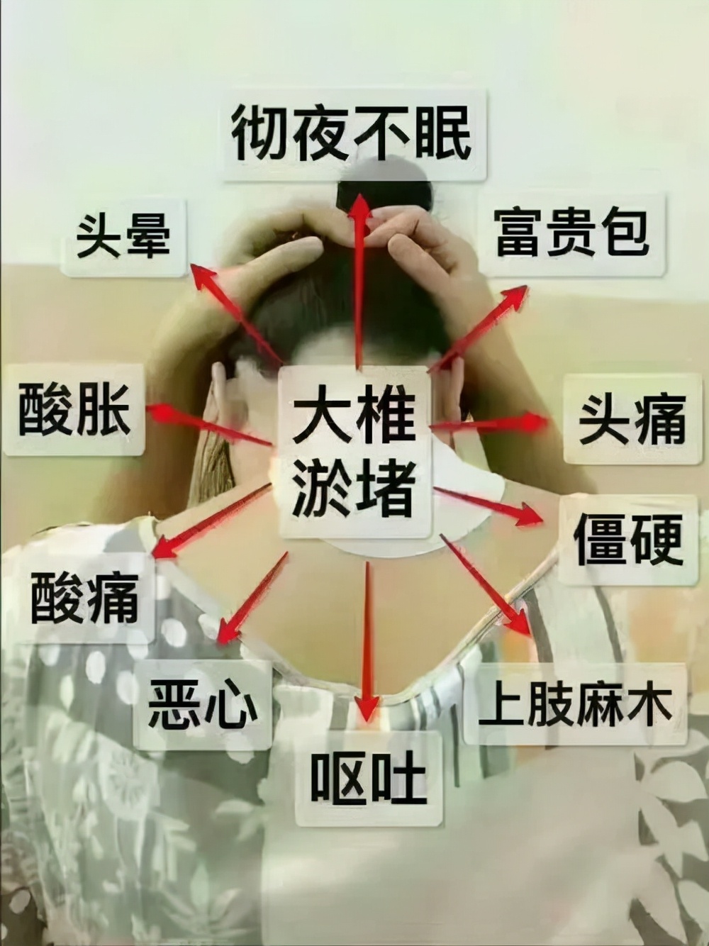 背部长了烦人的“富贵包”？4则医案告诉你，中医随证加减治疗