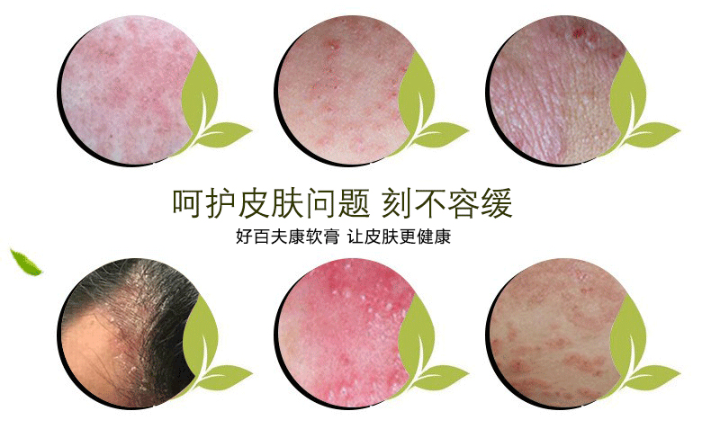 皮肤问题反复出现是怎么回事,皮肤瘙痒反复发作是什么原因