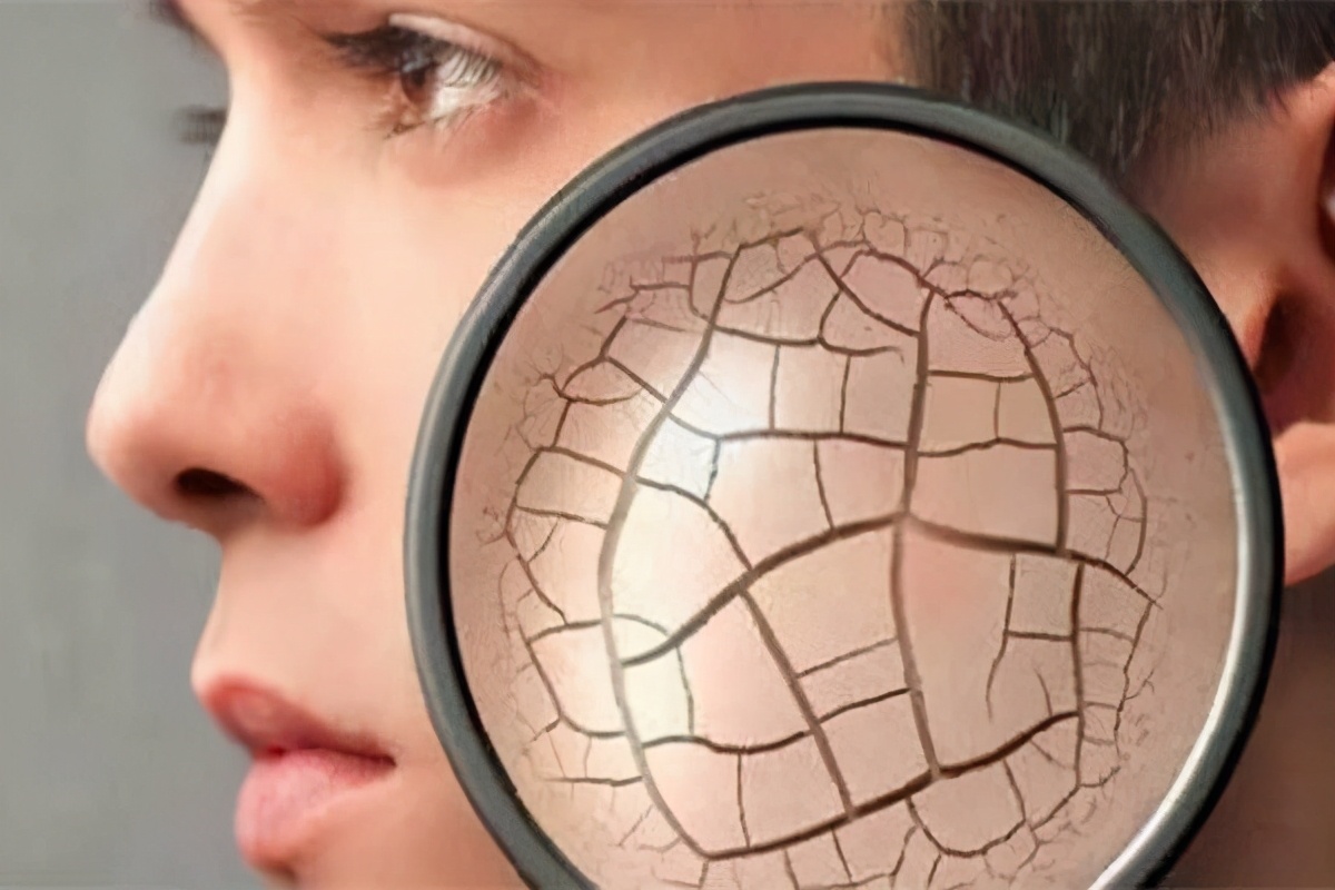 孕妇身体干燥起皮怎么补水最快,冬季孕妈皮肤干燥怎么办