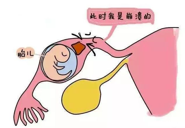 紧急避孕药真的危害这么大吗,避孕药为什么叫后悔药