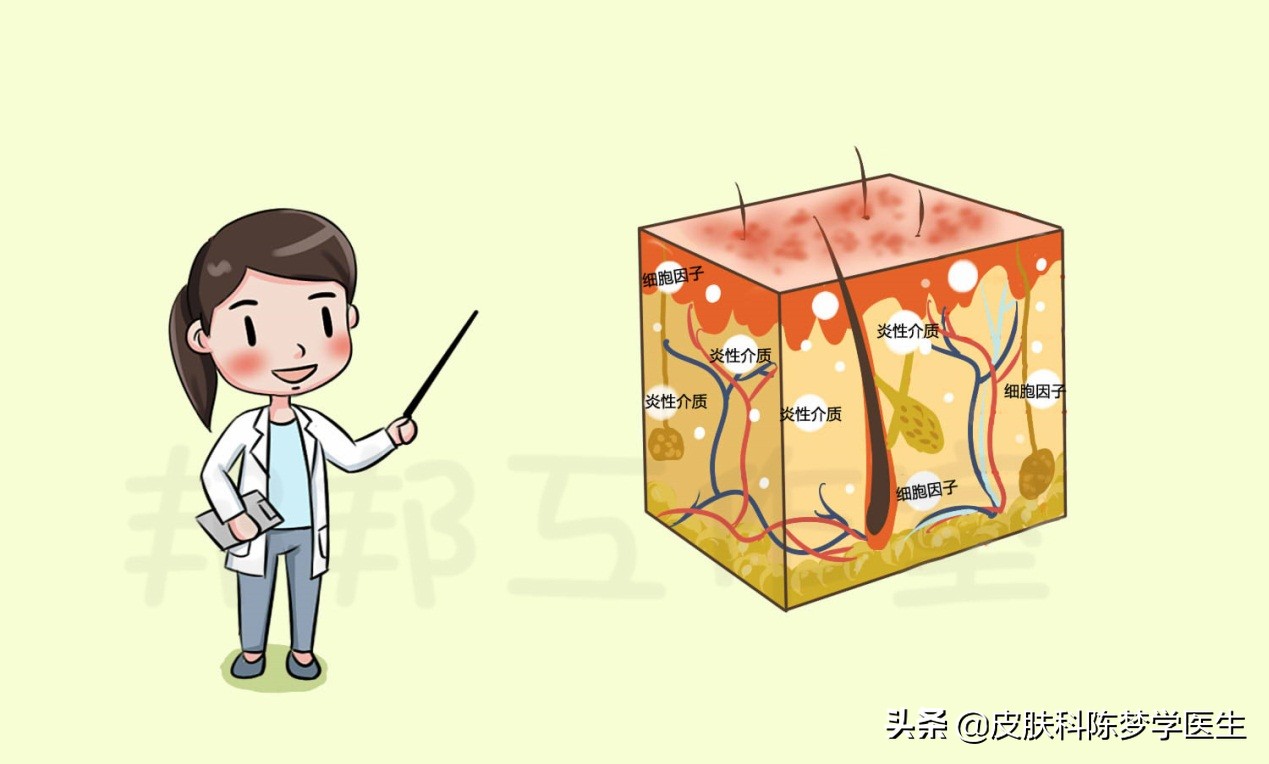 湿疹痒痒痒，该如何分期治疗？