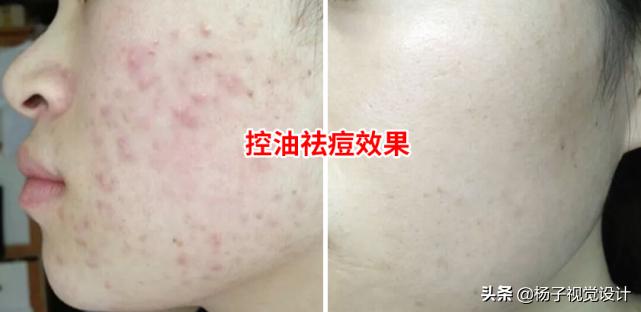 海藻籽面膜的功效与作用,海藻面膜的作用与用途有哪些