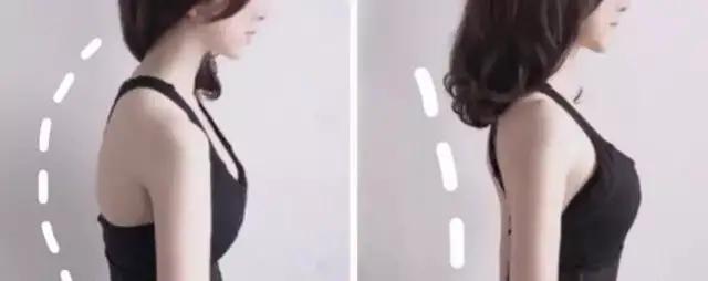 如何通过健身矫正含胸驼背
