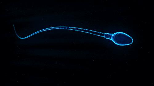 没有胎心是什么原因造成的胎停,为什么第一胎胎停不建议查原因