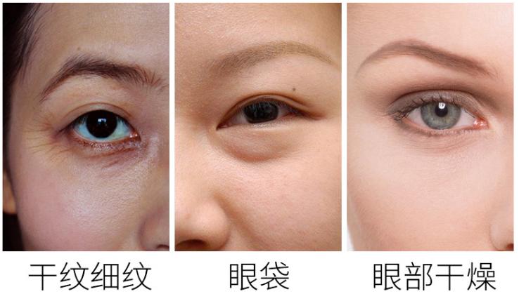 在人人爱美的时代，黑眼圈很重怎么办？缓解黑眼圈的有效办法推荐