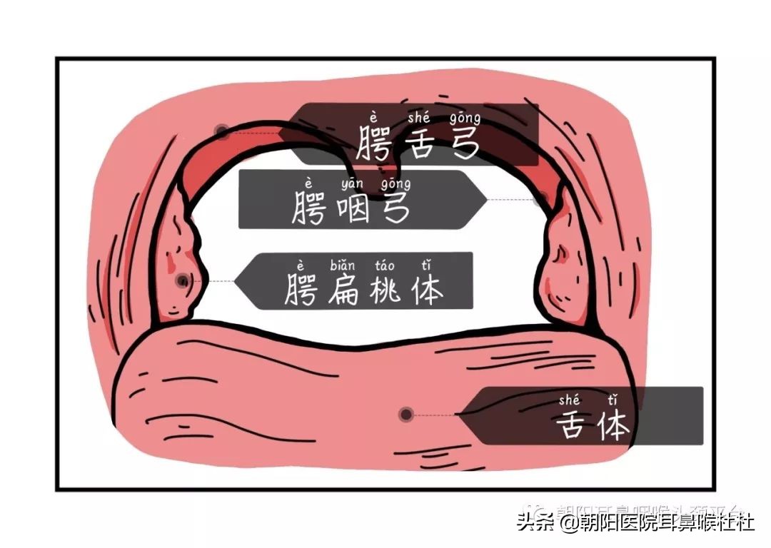 扁桃体是属于咽喉吗,扁桃体属于上咽部还是下咽部