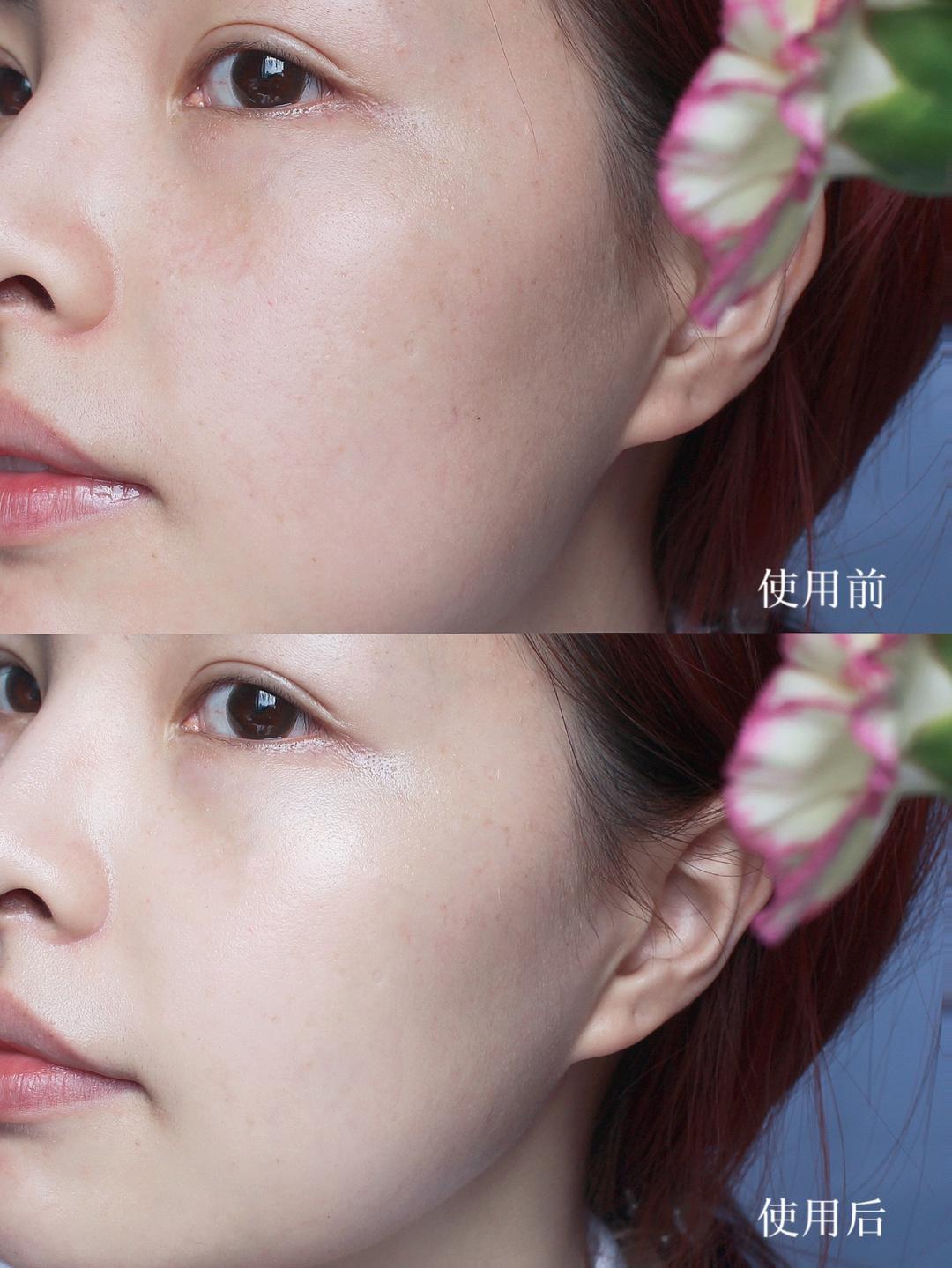 4款换季必备“面霜”！高保湿还水润，修复敏感肌，不再泛红刺痛