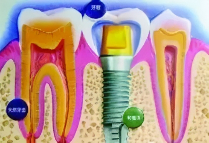 雅悦齿科口碑怎么样,上海雅悦齿科价目表