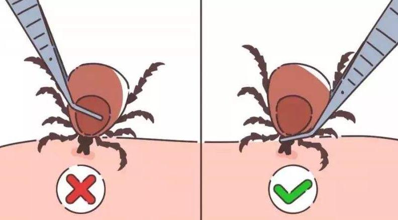 各种虫咬伤疼痛怎么处理,虫咬伤真的会致命吗