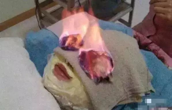 网红花5万赴日本洗血：这些自杀式美容法，正在收割你的智商税