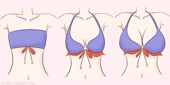 医生有什么丰胸的办法,专家分析丰胸的好方法