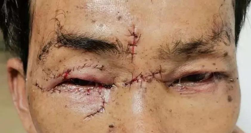 龙岩二院眼科预约电话,龙岩二院眼科在东院吗