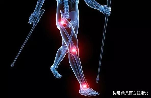 为什么关节炎发病会无力,风湿关节炎真的没得治了吗