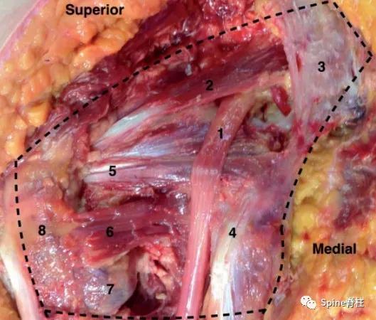 下肢疼痛是腰椎间盘突出引起的吗,下肢放射痛查不出原因