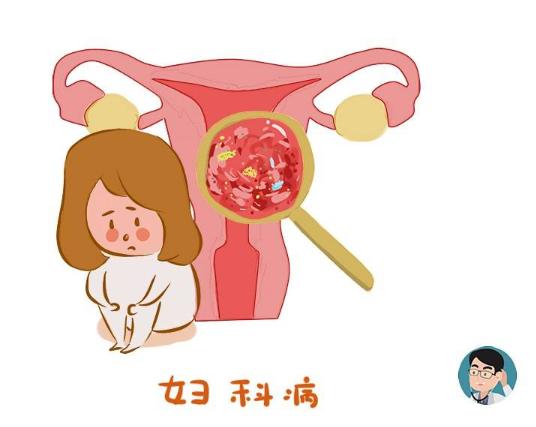 身体左侧下隐痛要当心,下腹旁边疼痛要警惕三种病