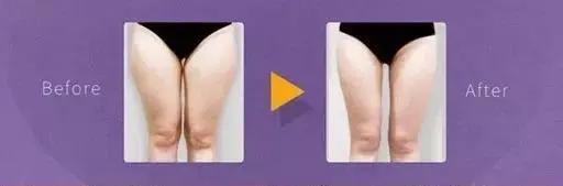 吴昕粗腿对比图,34岁的吴昕近照曝光