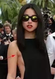 超模消除副乳,超模收副乳