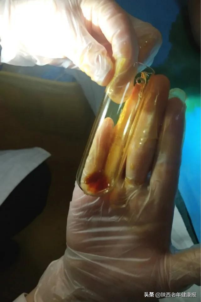 「硬核技术」男友为25岁“石女”寻医