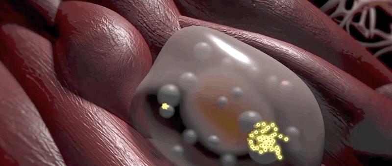 哮喘过敏症的症状,呼吸道过敏哮喘症状