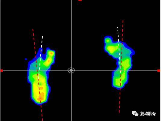 怎样分解八字求详细解说,解读八字教学