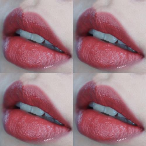 骨相凹陷怎么办,骨相扁平怎么改善