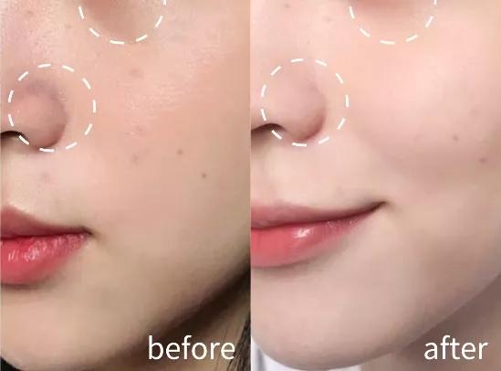 用了很多护肤品还是不白,白月光护肤品哪个更提亮皮肤