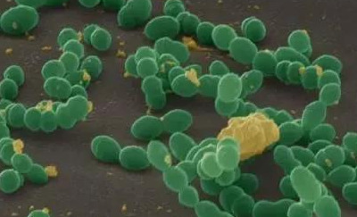 上厕所被水花溅到怎么处理,小便时被马桶水溅到了怎么处理