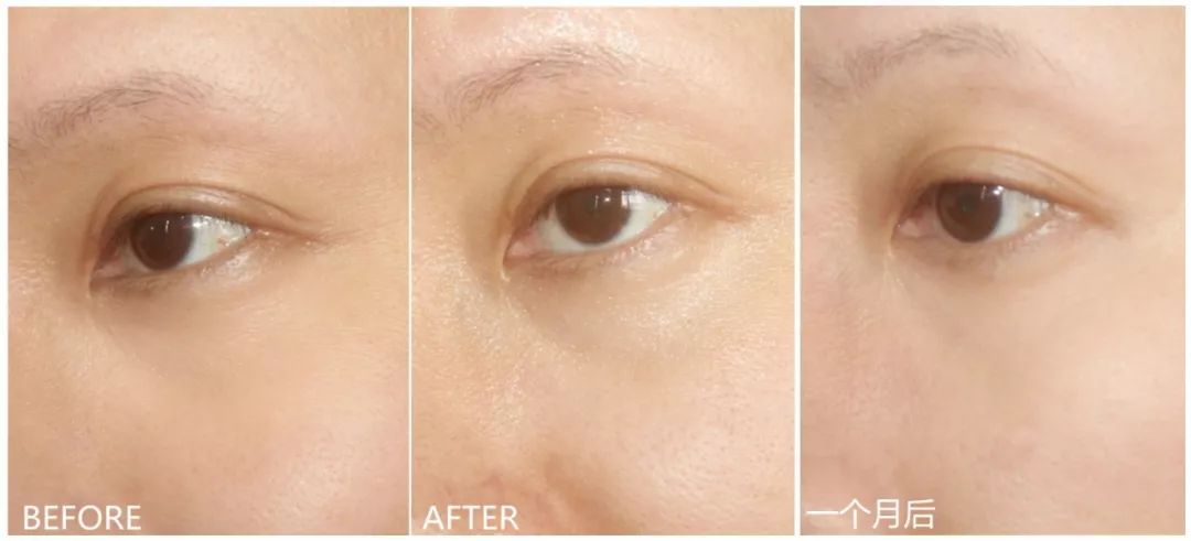 兰蔻彩妆明星同款产品有哪些,兰蔻明星大红瓶